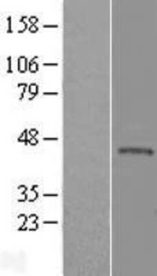 Western Blot: KLHDC3 Overexpression Lysate (Adult Normal) [NBL1-12326] Left-Empty vector transfected control cell lysate (HEK293 cell lysate); Right -Over-expression Lysate for KLHDC3.