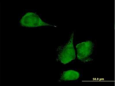 Immunocytochemistry/Immunofluorescence: KLHDC4 Antibody [H00054758-B01P] - Analysis of purified antibody to KLHDC4 on HeLa cell. (antibody concentration 10 ug/ml)