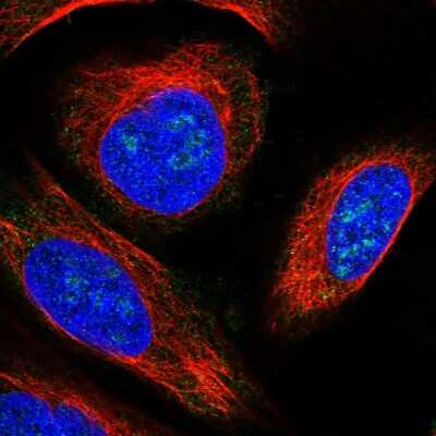 Immunocytochemistry/Immunofluorescence: KLHDC4 Antibody [NBP1-85129] - Immunofluorescent staining of human cell line U-2 OS shows localization to nucleoli.