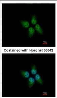 Immunocytochemistry/Immunofluorescence: KLHDC4 Antibody [NBP2-17072] - Immunofluorescence analysis of paraformaldehyde-fixed A431, using antibody at 1:500 dilution.