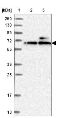 Western Blot: KLHDC4 Antibody [NBP1-85129] - Lane 1: Marker  [kDa] 250, 130, 95, 72, 55, 36, 28, 17, 10.  Lane 2: Human cell line RT-4.  Lane 3: Human cell line U-251MG sp