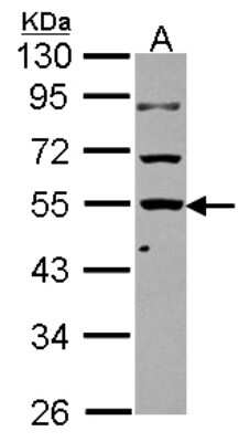 Western Blot: KLHDC4 Antibody [NBP2-17072] - Sample (30 ug of whole cell lysate) A: A431 10% SDS PAGE gel, diluted at 1:1000.
