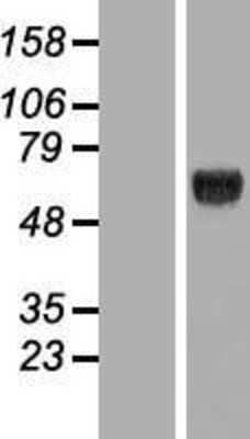 Western Blot KLHDC4 Overexpression Lysate