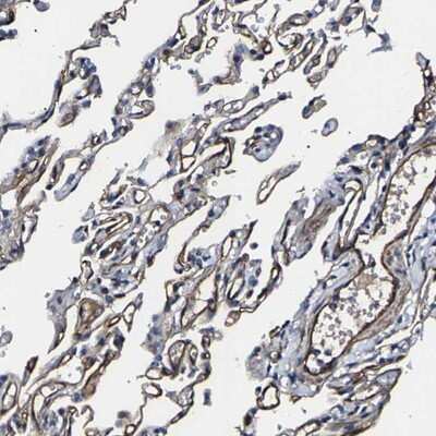 Immunohistochemistry-Paraffin: KLHDC5 Antibody [NBP1-90612] - Staining of human lung shows strong positivity in endothelial cells.