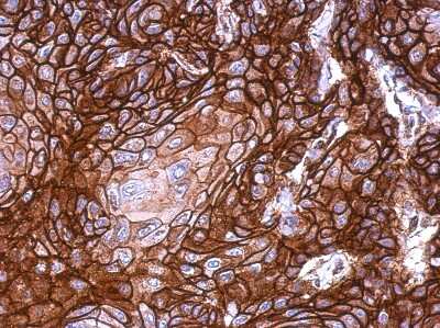 Immunohistochemistry-Paraffin: KLHDC5 Antibody [NBP2-17074] - Immunohistochemical analysis of paraffin-embedded mouse brain, using antibody at 1:500 dilution.