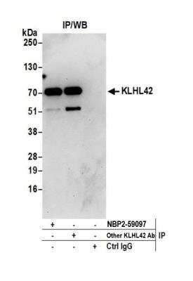 Immunoprecipitation: KLHDC5 Antibody [NBP2-59107] - Detection of human KLHL42 by western blot of immunoprecipitates. Samples: Whole cell lysate (0.5 or 1.0 mg per IP reaction; 20% of IP loaded) from 293T cells prepared using NETN lysis buffer. Antibodies: Affinity purified rabbit anti-KLHL42 antibody NBP2-59107 used for IP at 20 ul per reaction. KLHL42 was also immunoprecipitated by another rabbit anti-KLHL42 antibody. For blotting immunoprecipitated KLHL42, NBP2-59107 was used at 1:250. Detection: Chemiluminescence with an exposure time of 30 seconds.