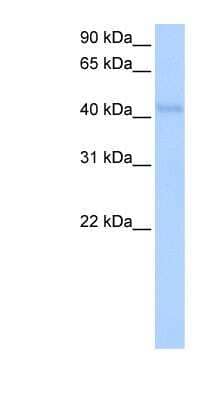 Western Blot: KLHDC5 Antibody [NBP1-91421] - HepG2 cell lysate, concentration 0.2-1 ug/ml.