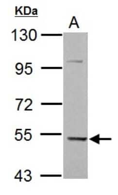 Western Blot: KLHDC5 Antibody [NBP2-17074] - Sample (30 ug of whole cell lysate) A: HepG2 7. 5% SDS PAGE gel, diluted at 1:1000.