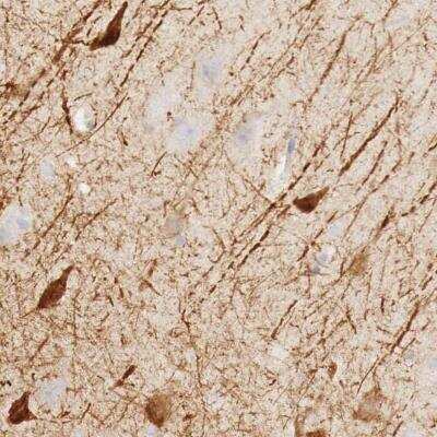 Immunohistochemistry-Paraffin: KLHDC7B Antibody [NBP1-81188] - Staining of human cerebral cortex shows strong cytoplasmic positivity in neuronal cells and neuropil.