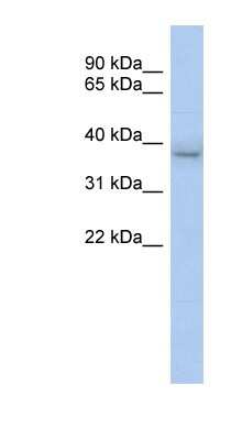 Western Blot: KLHDC8B Antibody [NBP1-70591] - Titration: 0.2-1 ug/ml, Positive Control: Human Stomach.