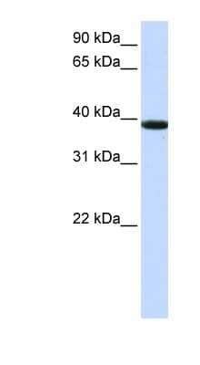 Western Blot: KLHDC8B Antibody [NBP1-70592] - Jurkat cell lysate, concentration 0.2-1 ug/ml.