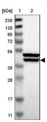 Western Blot: KLHDC8B Antibody [NBP1-82703] - Lane 1: Marker  [kDa] 230, 130, 95, 72, 56, 36, 28, 17, 11.  Lane 2: Human cell line RT-298