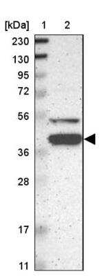 Western Blot: KLHDC8B Antibody [NBP1-82704] - Lane 1: Marker  [kDa] 230, 130, 95, 72, 56, 36, 28, 17, 11.  Lane 2: Human cell line RT-299