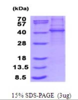 SDS-Page: KLHDC8B Recombinant Protein [NBP2-51874] - 15% SDS Page (3 ug)