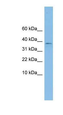 Western Blot: KLHDC9 Antibody [NBP1-57735] - OVCAR-3 cell lysate, concentration 0.2-1 ug/ml.