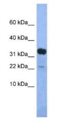 Western Blot: KLHDC9 Antibody [NBP1-79471] - Mouse Pancreas Lysate 1ug/ml  Gel Concentration 10-20%
