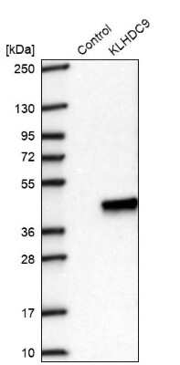 Western Blot: KLHDC9 Antibody [NBP2-48547] - Analysis in control (vector only transfected HEK293T lysate) and KLHDC9 over-expression lysate (Co-expressed with a C-terminal myc-DDK tag (3.1 kDa) in mammalian HEK293T cells).