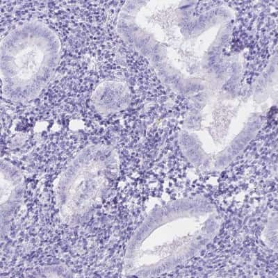 Immunohistochemistry-Paraffin: KLHL10 Antibody [NBP2-49518] - Staining of human endometrium shows low expression as expected.