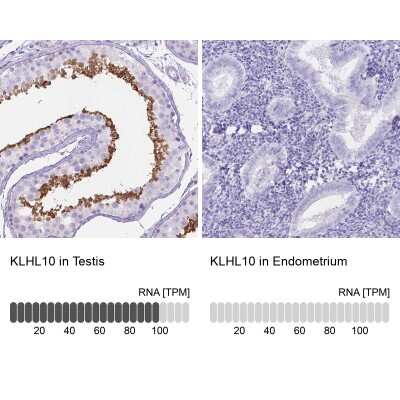 <b>Orthogonal Strategies Validation. </b>Immunohistochemistry-Paraffin: KLHL10 Antibody [NBP2-49518] - Staining in human testis and endometrium tissues using anti-KLHL10 antibody. Corresponding KLHL10 RNA-seq data are presented for the same tissues.