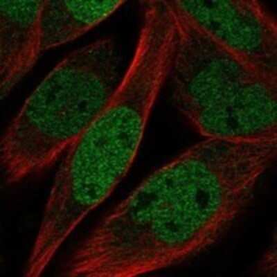Immunocytochemistry/Immunofluorescence: KLHL11 Antibody [NBP3-17389] - Staining of human cell line RH-30 shows localization to nucleoplasm.
