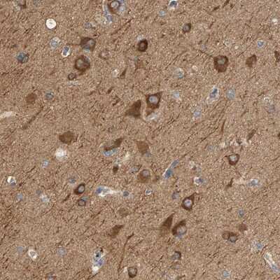 Immunohistochemistry-Paraffin: KLHL11 Antibody [NBP1-83846] - Staining of human cerebral cortex shows strong cytoplasmic positivity in neuronal cells.