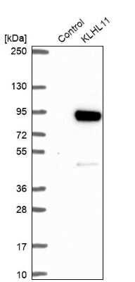 Western Blot: KLHL11 Antibody [NBP2-38721] - Analysis in control (vector only transfected HEK293T lysate) and KLHL11 over-expression lysate (Co-expressed with a C-terminal myc-DDK tag (3.1 kDa) in mammalian HEK293T cells).
