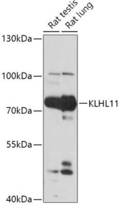 Western Blot: KLHL11 Antibody [NBP3-04762] - Analysis of extracts of various cell lines, using KLHL11 antibody at 1:1000 dilution. Secondary antibody: HRP Goat Anti-Rabbit IgG (H+L) at 1:10000 dilution. Lysates/proteins: 25ug per lane. Blocking buffer: 3% nonfat dry milk in TBST. Detection: ECL Basic Kit