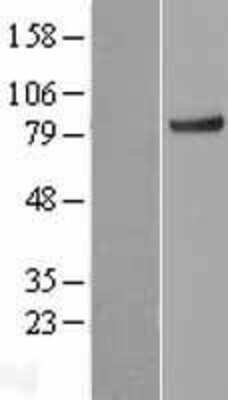 Western Blot: KLHL11 Overexpression Lysate (Adult Normal) [NBL1-12332] Left-Empty vector transfected control cell lysate (HEK293 cell lysate); Right -Over-expression Lysate for KLHL11.