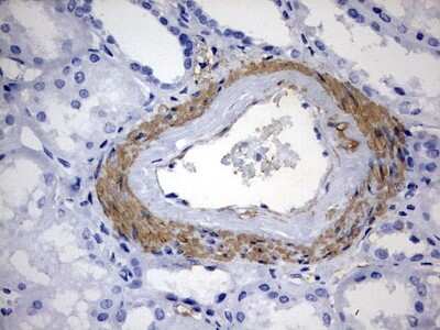 Immunohistochemistry: KLHL12/C3IP1 Antibody (4E1) [NBP2-45512] - Analysis of Human Kidney tissue. (Heat-induced epitope retrieval by 10mM citric buffer, pH6.0, 120C for 3min)