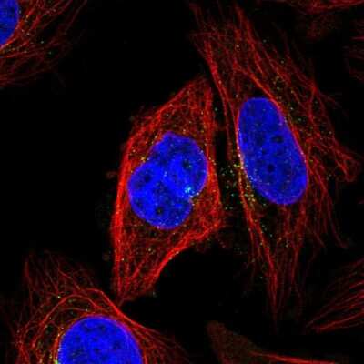 Immunocytochemistry/Immunofluorescence: KLHL12/C3IP1 Antibody [NBP2-56310] - Staining of human cell line SiHa shows localization to microtubule organizing center & vesicles.