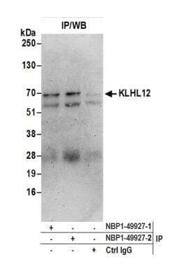 <b>Independent Antibodies Validation. </b>Immunoprecipitation: KLHL12/C3IP1 Antibody [NBP1-49927] - Detection of human KLHL12 by western blot of immunoprecipitates. Samples: Whole cell lysate (0.5 or 1.0 mg per IP reaction; 20% of IP loaded) from HEK293T cells prepared using NETN lysis buffer. Antibodies: Affinity purified rabbit anti-KLHL12 antibody NBP1-49927 (lot NBP1-49927-2 ) used for IP at 6 ug per reaction. KLHL12 was also immunoprecipitated by a previous lot of this antibody NBP1-49927-1. For blotting immunoprecipitated KLHL12, NBP1-49927 was used at 1 ug/ml. Detection: Chemiluminescence with an exposure time of 3 minutes.