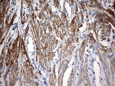 Immunohistochemistry: KLHL12/C3IP1 Antibody (OTI4E1) - Azide and BSA Free [NBP2-72118] - Analysis of Human endometrium tissue. (Heat-induced epitope retrieval by 10mM citric buffer, pH6.0, 120C for 3min)