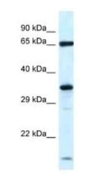 Western Blot: KLHL12/C3IP1 Antibody [NBP1-82404] - Titration: 1.0 ug/ml Positive Control: Rat Brain.