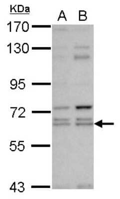 Western Blot: KLHL12/C3IP1 Antibody [NBP2-17077] - Sample (30 ug of whole cell lysate) A: NT2D1 B: IMR32 7. 5% SDS PAGE gel, diluted at 1:1000.