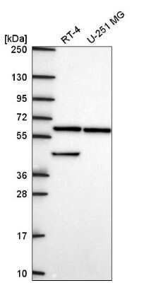 Western Blot: KLHL12/C3IP1 Antibody [NBP2-56310] - Western blot analysis in human cell line RT-4 and human cell line U-251 MG.