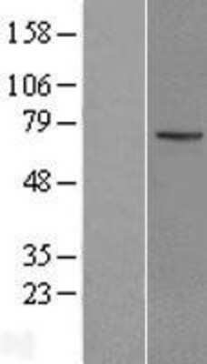 Western Blot: KLHL13 Overexpression Lysate (Adult Normal) [NBL1-12334] Left-Empty vector transfected control cell lysate (HEK293 cell lysate); Right -Over-expression Lysate for KLHL13.