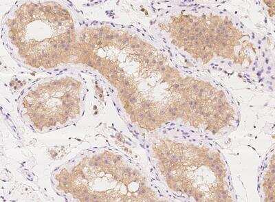 Immunohistochemistry-Paraffin: KLHL17 Antibody [NBP3-06047] - Staining of human KLHL17 in human testis with rabbit polyclonal antibody at 1:1000 dilution.