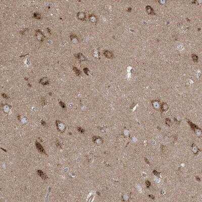 Immunohistochemistry: KLHL18 Antibody [NBP1-94017] - Staining of human hippocampus shows strong cytoplasmic positivity in neuronal cells.