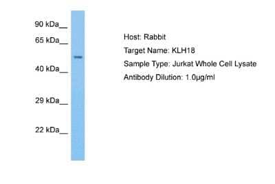 Western Blot: KLHL18 Antibody [NBP2-85160] - Host: Rabbit. Target Name: KLHL18. Sample Tissue: Human Jurkat Whole Cell. Antibody Dilution: 1.0ug/ml