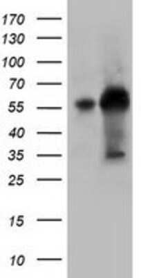 Western Blot KLHL2 Antibody (OTI1G7)