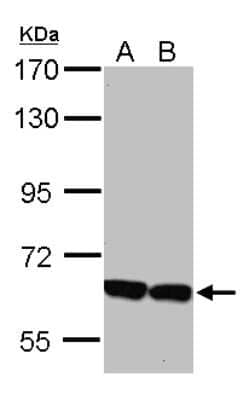 Western Blot: KLHL2 Antibody [NBP2-17080] - Sample (30 ug of whole cell lysate) A: 293T B: A431 7. 5% SDS PAGE gel, diluted at 1:5000.