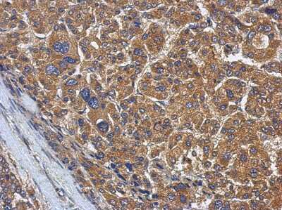 Immunohistochemistry-Paraffin KLHL22 Antibody