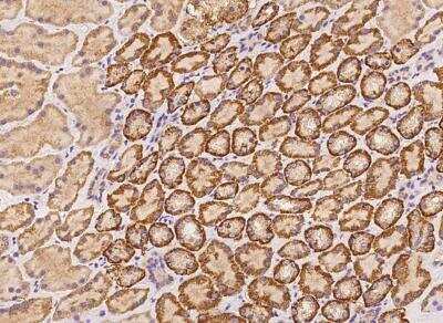 Immunohistochemistry-Paraffin: KLHL24 Antibody [NBP3-05979] - Staining of human KLHL24 in human kidney with rabbit polyclonal antibody at 1:100 dilution.