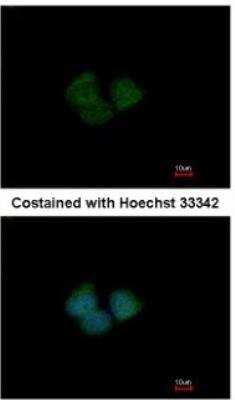Immunocytochemistry/Immunofluorescence: KLHL25 Antibody [NBP2-17082] - Analysis of methanol-fixed MCF-7, using antibody at 1:200 dilution.