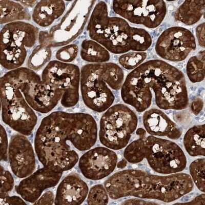 Immunohistochemistry-Paraffin: KLHL25 Antibody [NBP1-83974] - Staining of human kidney shows strong cytoplasmic positivity in cells in tubules.