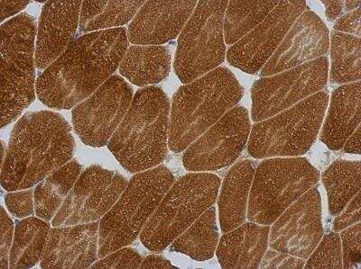 Immunohistochemistry-Paraffin: KLHL25 Antibody [NBP2-17082] - Immunohistochemical analysis of paraffin-embedded Muscle, using antibody at 1:500 dilution.