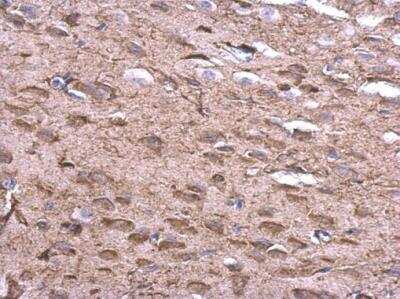 Immunohistochemistry-Paraffin: KLHL25 Antibody [NBP2-17082] - KLHL25 antibody detects KLHL25 protein at cytosol on rat fore brain by immunohistochemical analysis. Sample: Paraffin-embedded rat fore brain. KLHL25 antibody dilution: 1:500.