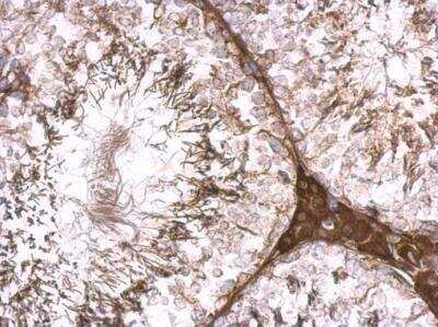 Immunohistochemistry-Paraffin: KLHL25 Antibody [NBP2-17082] - KLHL25 antibody detects KLHL25 protein at cytosol on mouse testis by immunohistochemical analysis. Sample: Paraffin-embedded mouse testis. KLHL25 antibody dilution: 1:500.