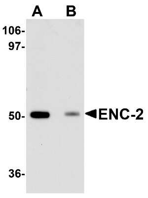Western Blot KLHL25 Antibody - BSA Free