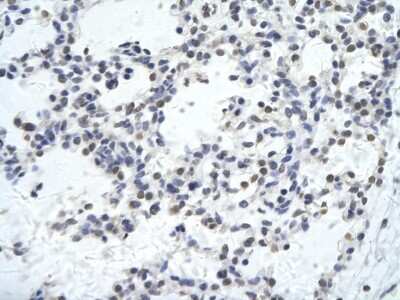 Immunohistochemistry-Paraffin: KLHL26 Antibody [NBP2-83116] - Rabbit Anti-KLHL26 antibody. Paraffin Embedded Tissue: Human Lung cell. Cellular Data: Epithelial cells of renal tubule. Antibody Concentration: 4.0-8.0 ug/ml. Magnification: 400X
